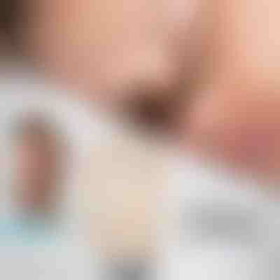 Dilatatore nasale magnetico | EASYBREATHE